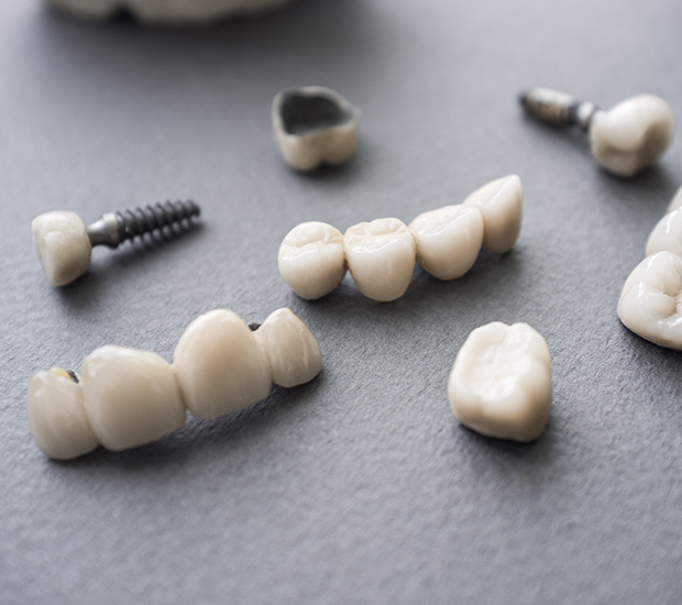 City of Industry The Difference Between Dental Implants and Mini Dental Implants